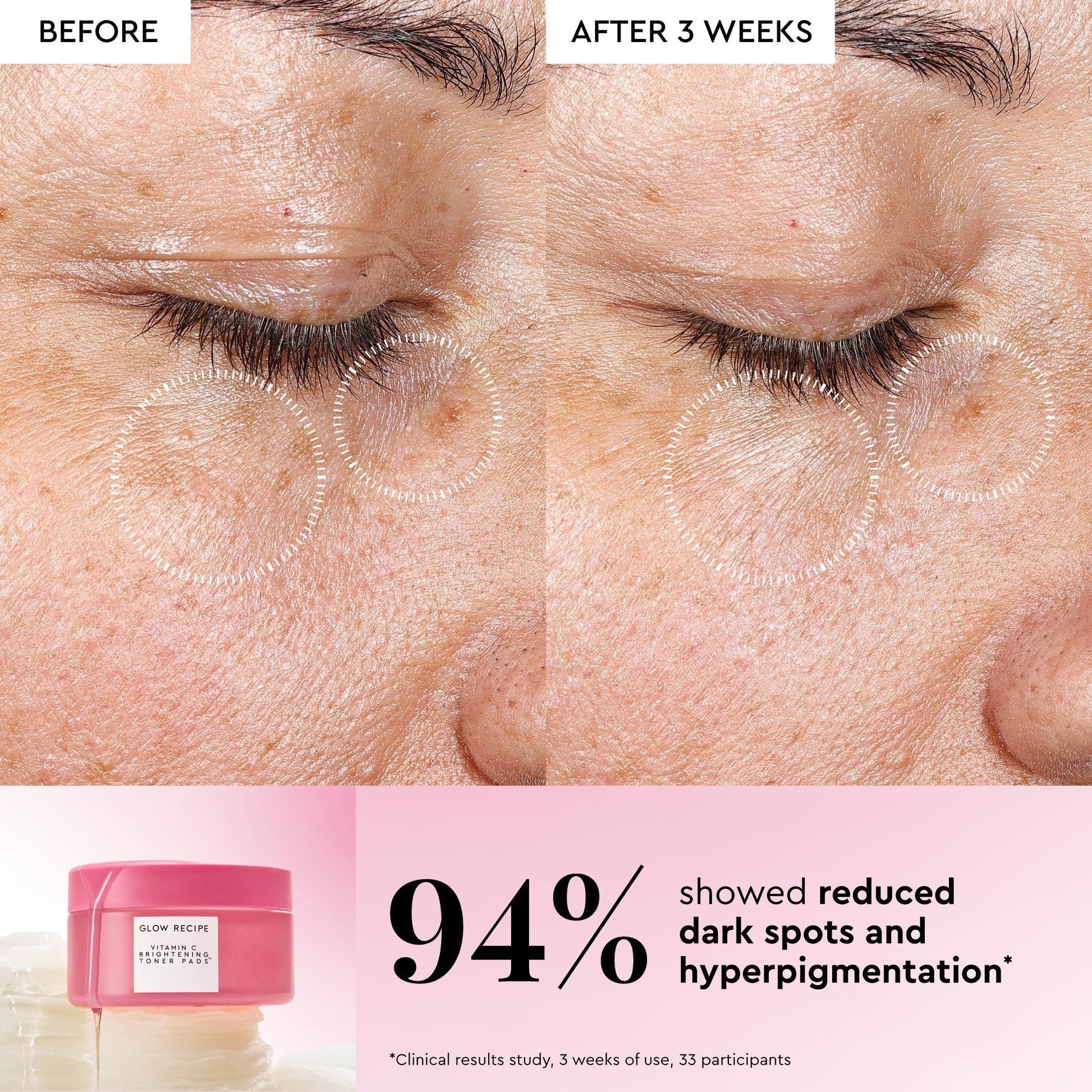 Korean Toner Pad Trial & Travel Kit